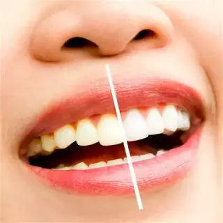 Dentista Cosmético en Rialto