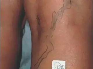 ¿Tiene dolores en las piernas?