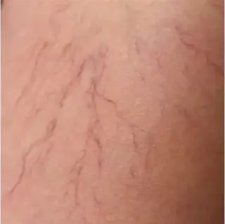 ¿Tiene dolores en las piernas?