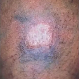 ¿Tiene dolores en las piernas?