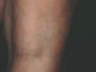 ¿Tiene dolores en las piernas?