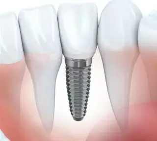 DENTISTA FAMILIAR Y COSMÉTICO