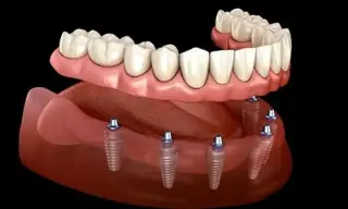 DENTISTA COSMETICO