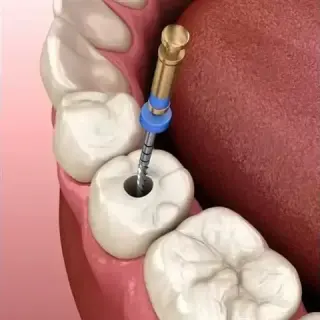 Dentista Cosmético