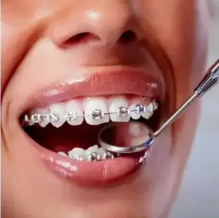 Dentista Cosmético
