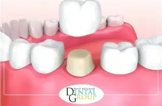 DENTISTA CERCA DE MÍ
