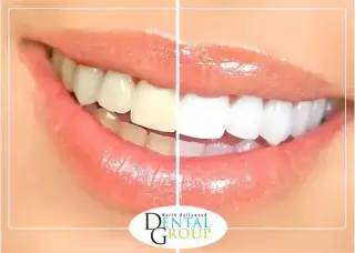 DENTISTA CERCA DE MÍ