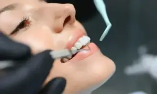 Implantes dentales desde $1999