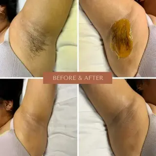 DEPILACION PARA HOMBRE/MUJER