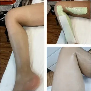 DEPILACION PARA HOMBRE/MUJER