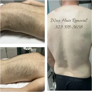 DEPILACION PARA HOMBRE/MUJER