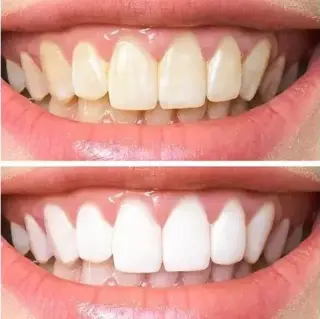MEJORANDO SONRISAS