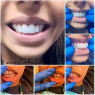 MEJORANDO SONRISAS
