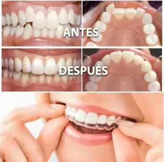 MEJORANDO SONRISAS