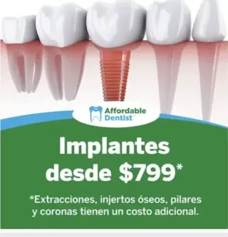 Implantes Dentales desde $799