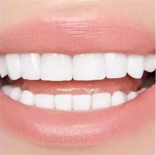 Implantes Dentales desde $799