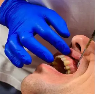 Implantes Dentales desde $799