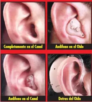 ¿Problemas para escuchar?