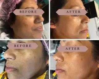 FACIAL LIMPIEZA PROFUNDA