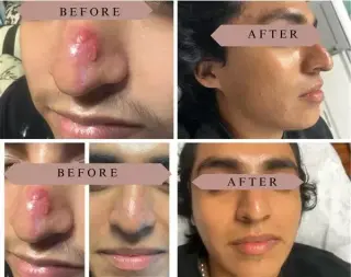 FACIAL LIMPIEZA PROFUNDA