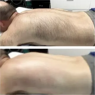 DEPILACION PARA HOMBRE/MUJER