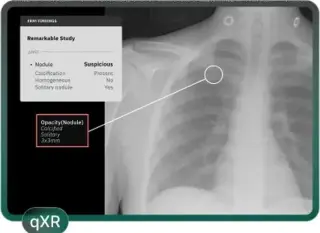 AI Detection & Follow-Up