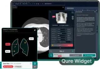 AI Detection & Follow-Up