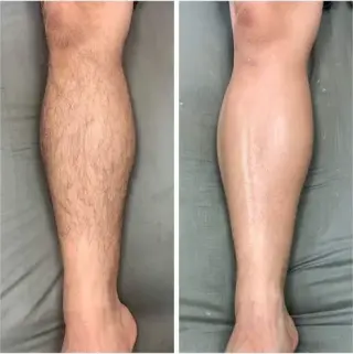 BODY SCRUB WAX DEPILACION