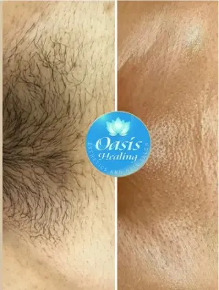 CURSO WAX DEPILACION CERA