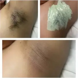 DEPILACION CERA WAX O MAQUINA