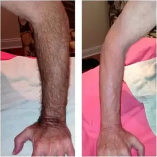 DEPILACION CON CERA BIKINI