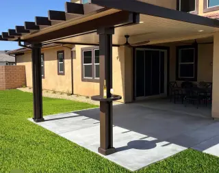 Alumawood Mundo Patio Covers