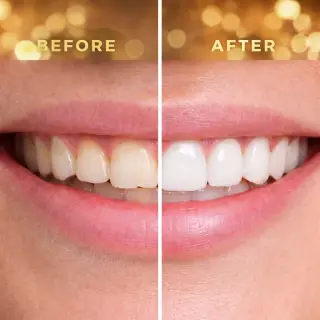 ¡Transforma Tu Sonrisa con Smile Avenue Dental Group!