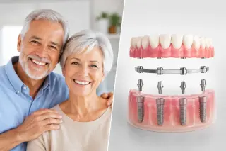 ¡Dentaduras en Pico Rivera — Smile Avenue Dental Group!