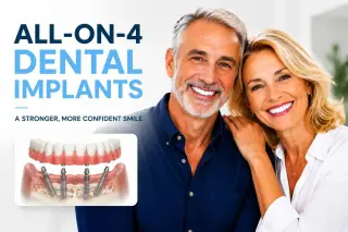 ¡Dentaduras en Pico Rivera — Smile Avenue Dental Group!