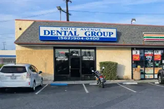 🦷 Extracción Dental en Pico Rivera — Smile Avenue Dental Group