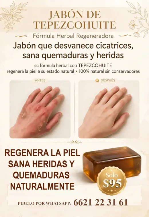 Jabón de Tepezcohuite que ayuda con quemaduras y heridas