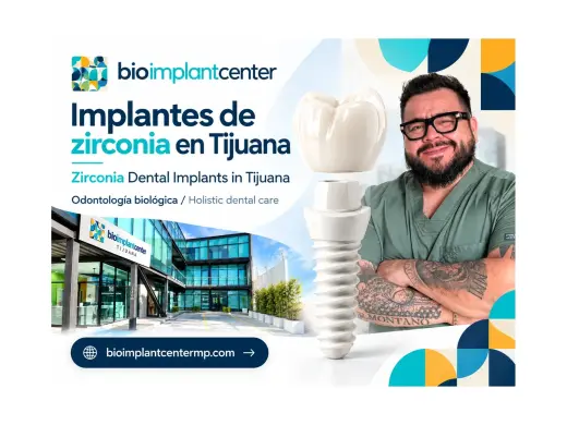 Implantes dentales de zirconia en Tijuana