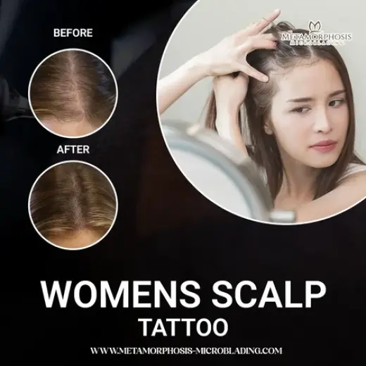 Women's SMP: Maintenance-Free