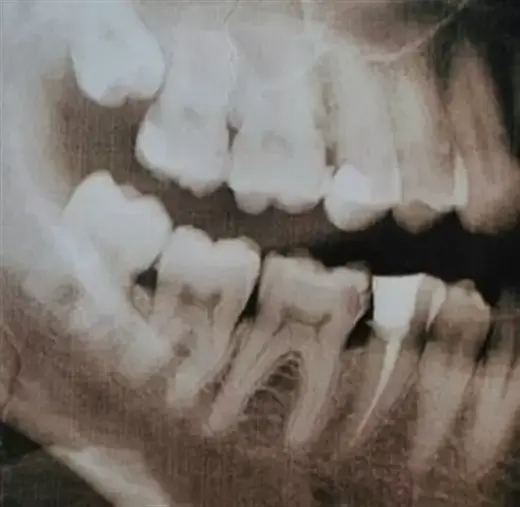 DENTISTA CON PRECIOS BAJOS