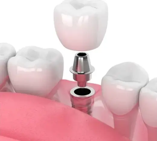 Dentista en Upland