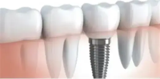 DENTISTA PARA LA FAMILIA