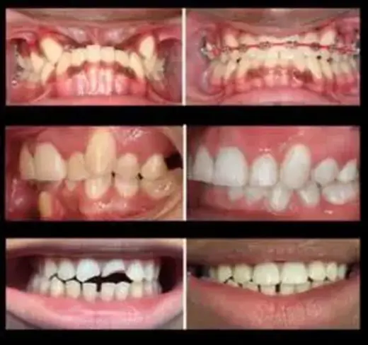 SONRISA PERFECTA EN VAN NUYS