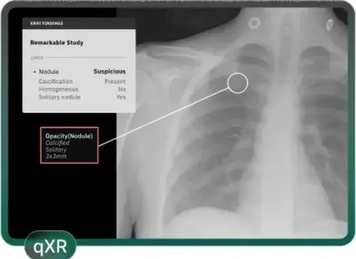 AI Detection & Follow-Up