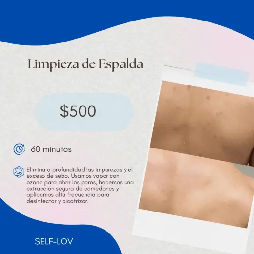 Elimina impurezas y exceso de grasa en la espalda por $500